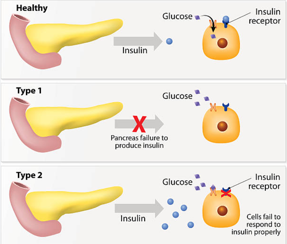 diabetes mellitus treatment